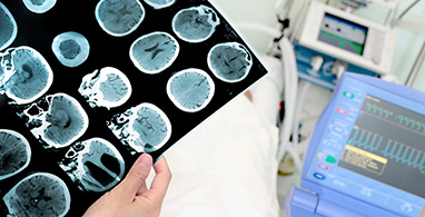 Neurolog